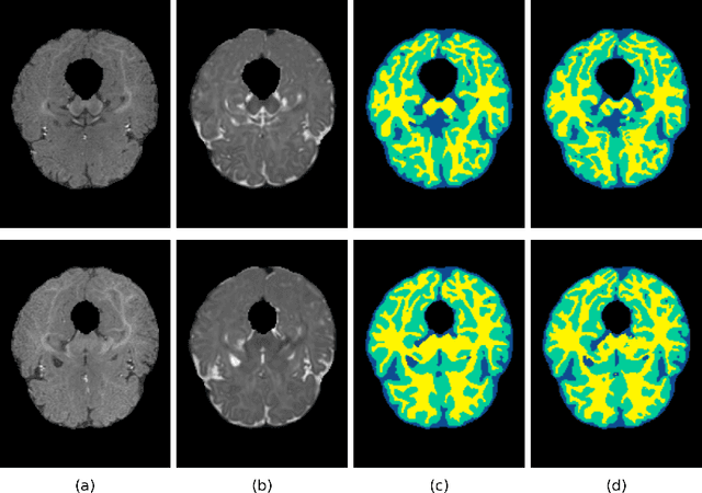 Figure 3 for 3D Densely Convolutional Networks for Volumetric Segmentation