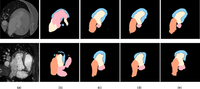 Figure 1 for Shape-consistent Generative Adversarial Networks for multi-modal Medical segmentation maps