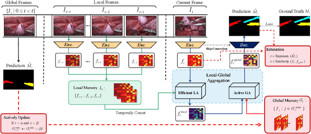 Figure 1 for Efficient Global-Local Memory for Real-time Instrument Segmentation of Robotic Surgical Video