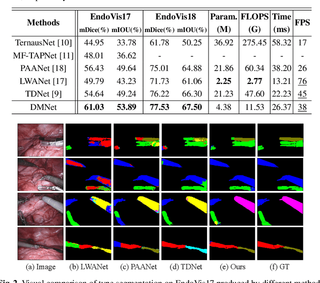 Figure 2 for Efficient Global-Local Memory for Real-time Instrument Segmentation of Robotic Surgical Video