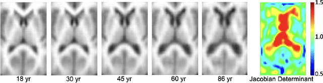 Figure 3 for Variational AutoEncoder For Regression: Application to Brain Aging Analysis