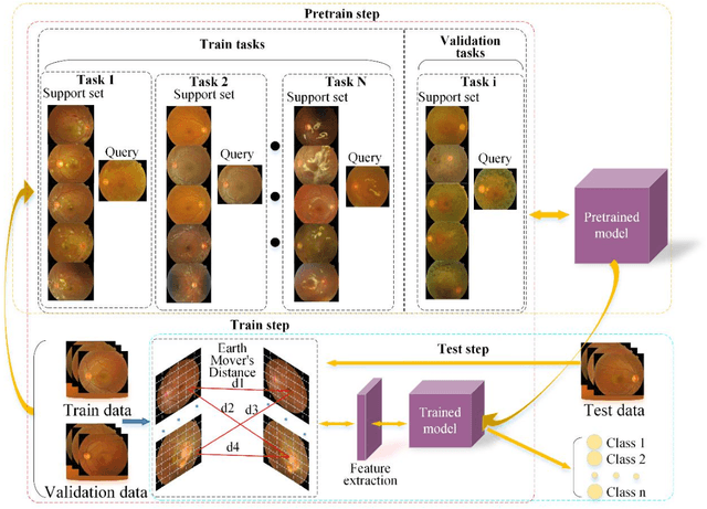 Figure 3 for FEDI: Few-shot learning based on Earth Mover's Distance algorithm combined with deep residual network to identify diabetic retinopathy