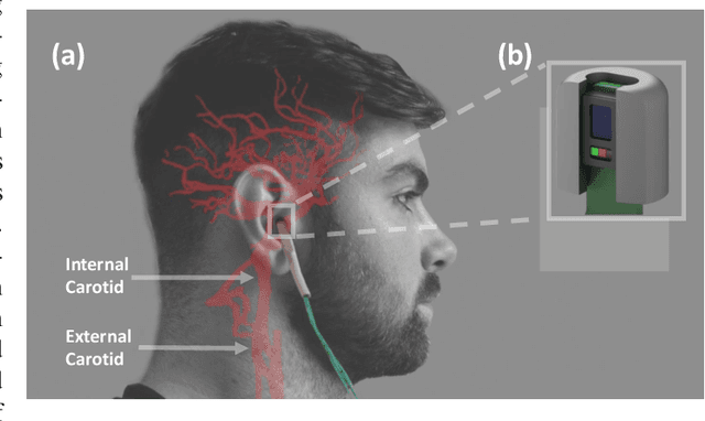Figure 1 for In-Ear SpO2 for Classification of Cognitive Workload
