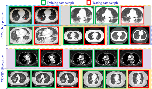Figure 1 for Resetting the baseline: CT-based COVID-19 diagnosis with Deep Transfer Learning is not as accurate as widely thought