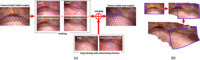 Figure 3 for Real-time Nonrigid Mosaicking of Laparoscopy Images