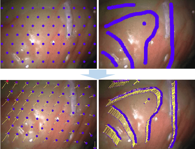 Figure 4 for Real-time Nonrigid Mosaicking of Laparoscopy Images