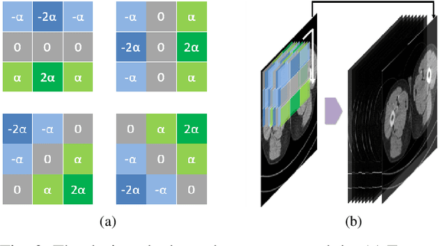 Figure 2 for EDCNN: Edge enhancement-based Densely Connected Network with Compound Loss for Low-Dose CT Denoising