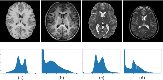 Figure 1 for A Lifelong Learning Approach to Brain MR Segmentation Across Scanners and Protocols