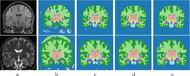 Figure 3 for A Lifelong Learning Approach to Brain MR Segmentation Across Scanners and Protocols