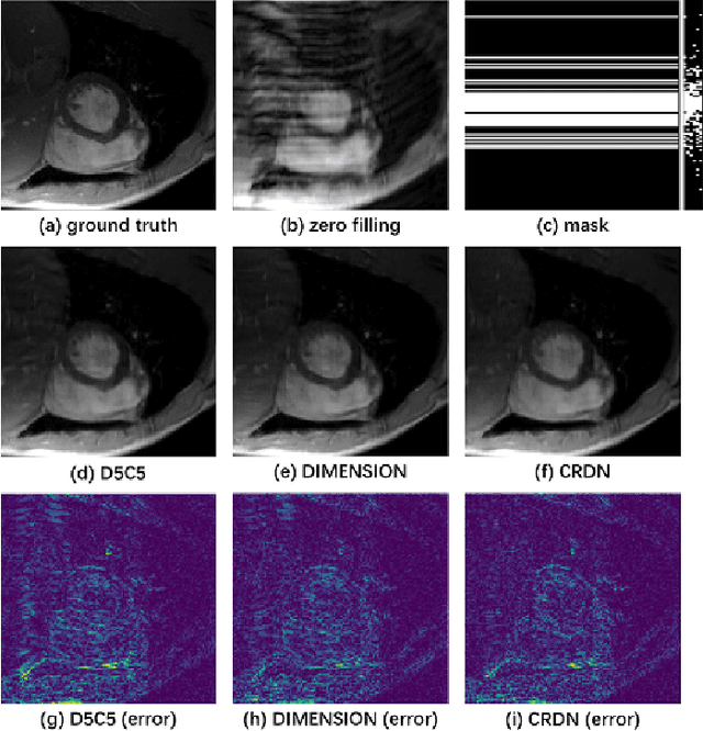 Figure 3 for CRDN: Cascaded Residual Dense Networks for Dynamic MR Imaging with Edge-enhanced Loss Constraint