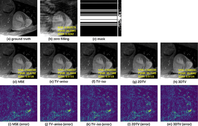 Figure 4 for CRDN: Cascaded Residual Dense Networks for Dynamic MR Imaging with Edge-enhanced Loss Constraint