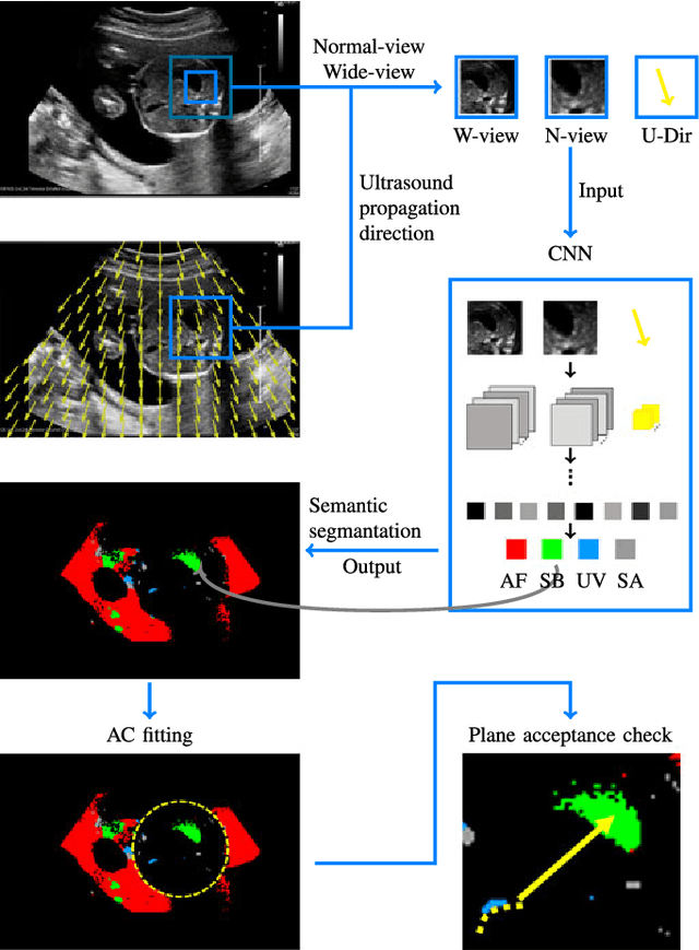 Figure 4 for Automatic Estimation of Fetal Abdominal Circumference from Ultrasound Images