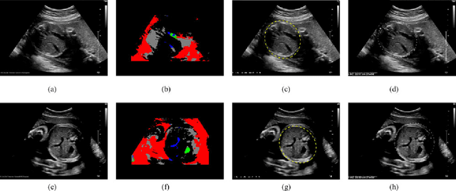Figure 2 for Automatic Estimation of Fetal Abdominal Circumference from Ultrasound Images