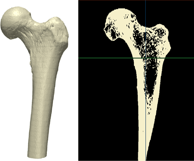 Figure 1 for Bayesian Convolutional Neural Networks as probabilistic surrogates for the fast prediction of stress fields in structures with microscale features