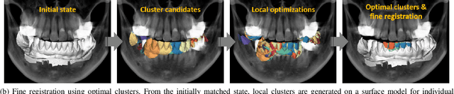 Figure 1 for Automatic Registration between Cone-Beam CT and Scanned Surface via Deep-Pose Regression Neural Networks and Clustered Similarities