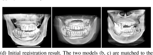 Figure 3 for Automatic Registration between Cone-Beam CT and Scanned Surface via Deep-Pose Regression Neural Networks and Clustered Similarities