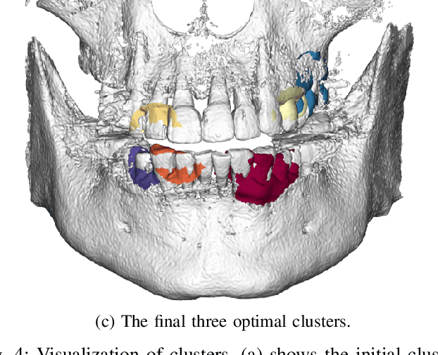 Figure 4 for Automatic Registration between Cone-Beam CT and Scanned Surface via Deep-Pose Regression Neural Networks and Clustered Similarities