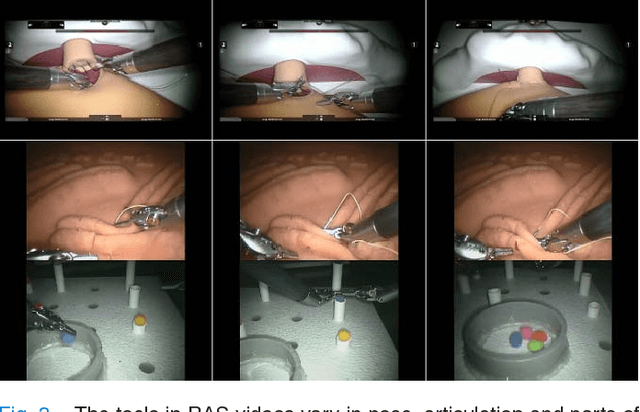 Figure 3 for Detection and Localization of Robotic Tools in Robot-Assisted Surgery Videos Using Deep Neural Networks for Region Proposal and Detection