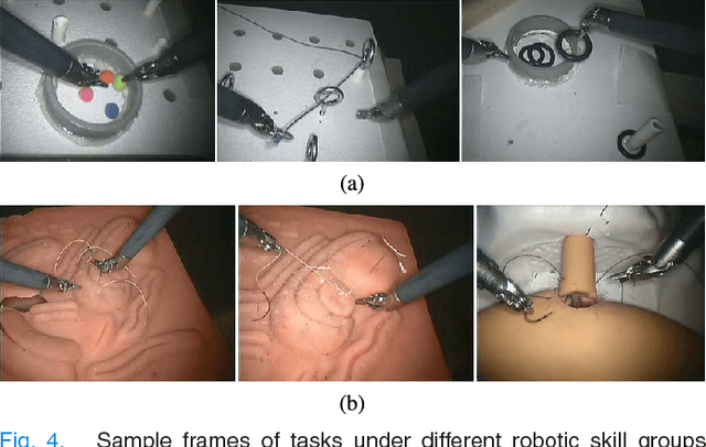 Figure 4 for Detection and Localization of Robotic Tools in Robot-Assisted Surgery Videos Using Deep Neural Networks for Region Proposal and Detection