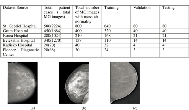 Figure 1 for Breast Cancer Detection Using Convolutional Neural Networks