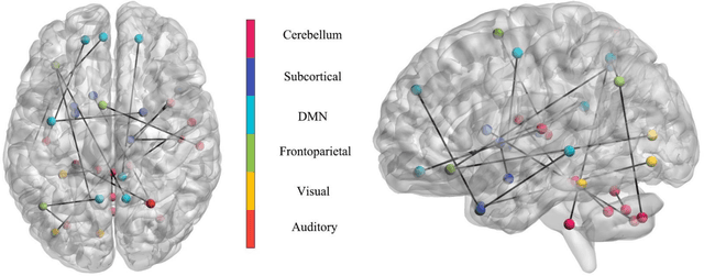 Figure 4 for Accelerated functional brain aging in major depressive disorder: evidence from a large scale fMRI analysis of Chinese participants