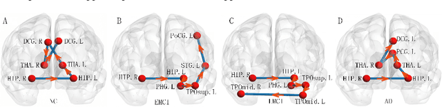 Figure 4 for Ordinal Pattern Kernel for Brain Connectivity Network Classification