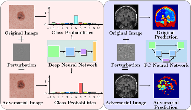 Figure 1 for Generalizability vs. Robustness: Adversarial Examples for Medical Imaging