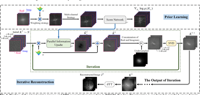 Figure 1 for WKGM: Weight-K-space Generative Model for Parallel Imaging Reconstruction