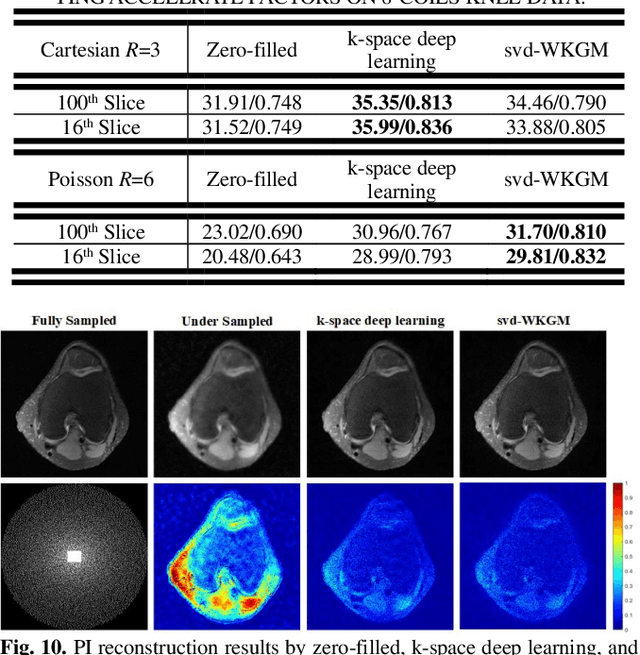 Figure 2 for WKGM: Weight-K-space Generative Model for Parallel Imaging Reconstruction