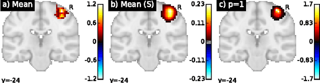 Figure 2 for Fast Optimal Transport Averaging of Neuroimaging Data