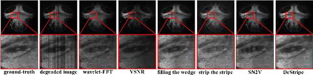 Figure 4 for DeStripe: A Self2Self Spatio-Spectral Graph Neural Network with Unfolded Hessian for Stripe Artifact Removal in Light-sheet Microscopy