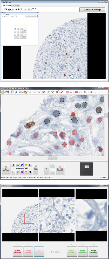 Figure 3 for Computational Pathology: Challenges and Promises for Tissue Analysis