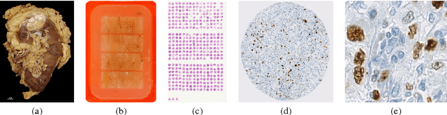 Figure 2 for Computational Pathology: Challenges and Promises for Tissue Analysis