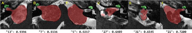 Figure 3 for Cross-Modality Domain Adaptation for Vestibular Schwannoma and Cochlea Segmentation