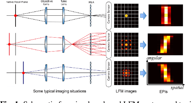 Figure 1 for Model-inspired Deep Learning for Light-Field Microscopy with Application to Neuron Localization