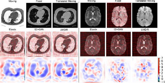 Figure 4 for Unsupervised Deformable Registration for Multi-Modal Images via Disentangled Representations