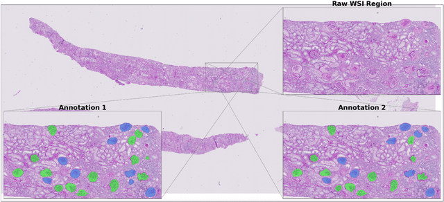 Figure 2 for U-Net-and-a-half: Convolutional network for biomedical image segmentation using multiple expert-driven annotations