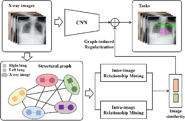Figure 1 for GREN: Graph-Regularized Embedding Network for Weakly-Supervised Disease Localization in X-ray images