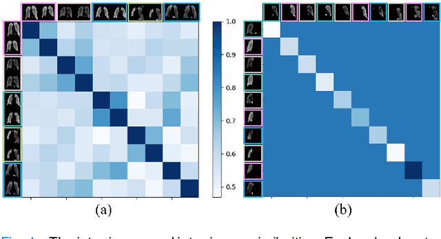 Figure 4 for GREN: Graph-Regularized Embedding Network for Weakly-Supervised Disease Localization in X-ray images