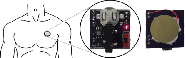 Figure 1 for DeepCough: A Deep Convolutional Neural Network in A Wearable Cough Detection System
