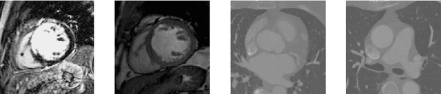 Figure 1 for Deep Class-Specific Affinity-Guided Convolutional Network for Multimodal Unpaired Image Segmentation