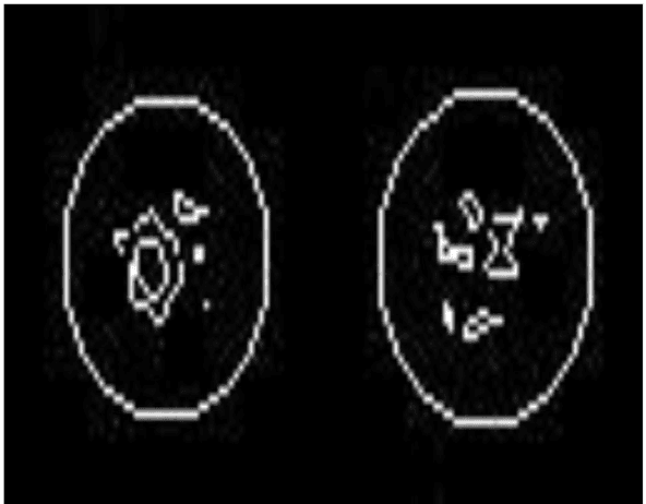 Figure 4 for Robust BGA Void Detection Using Multi Directional Scan Algorithms