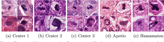 Figure 2 for Leveraging Unlabeled Whole-Slide-Images for Mitosis Detection