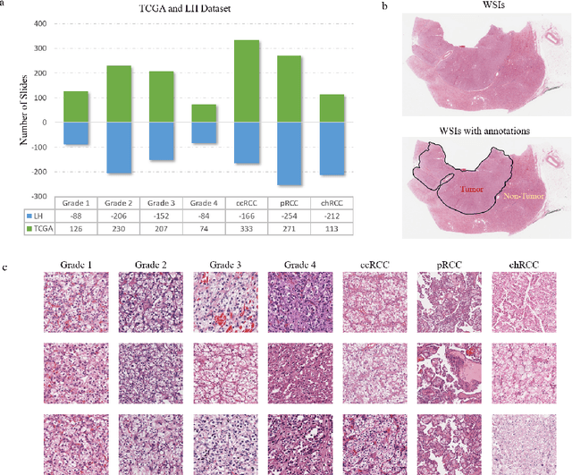 Figure 1 for A Precision Diagnostic Framework of Renal Cell Carcinoma on Whole-Slide Images using Deep Learning