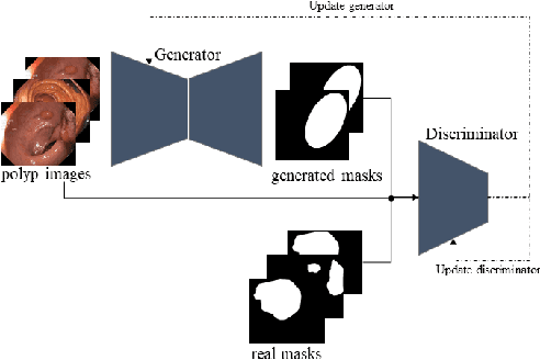 Figure 1 for Generative Adversarial Networks for Automatic Polyp Segmentation
