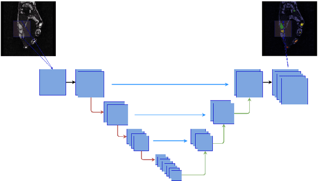 Figure 2 for CNN-based Segmentation of Medical Imaging Data