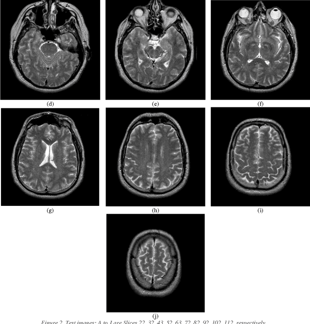 Figure 4 for Multilevel Thresholding Segmentation of T2 weighted Brain MRI images using Convergent Heterogeneous Particle Swarm Optimization