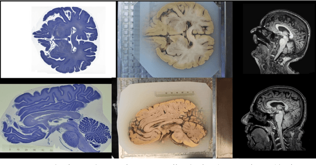 Figure 1 for Automating Whole Brain Histology to MRI Registration: Implementation of a Computational Pipeline