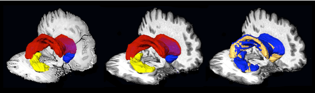 Figure 4 for Automating Whole Brain Histology to MRI Registration: Implementation of a Computational Pipeline