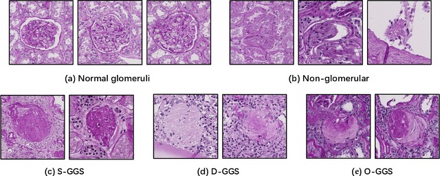 Figure 4 for Glo-In-One: Holistic Glomerular Detection, Segmentation, and Lesion Characterization with Large-scale Web Image Mining